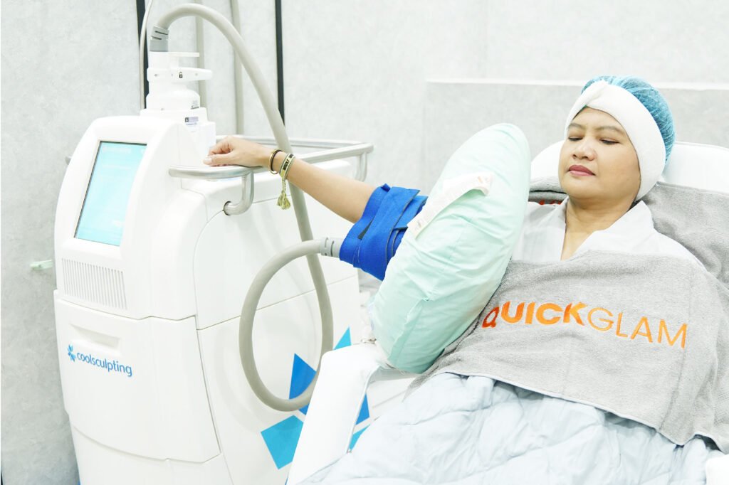 proses coolsculpting